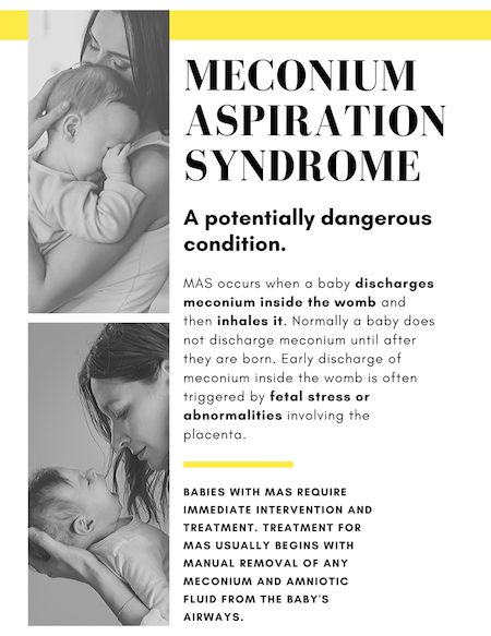 Meconium Aspiration Syndrome Infographic
