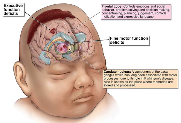 signs of baby head trauma