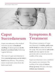 Caput Succedaneum | What Parents Should Know