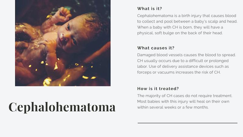 Cephalohematoma Infographic