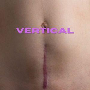 C-section Scars - Vertical