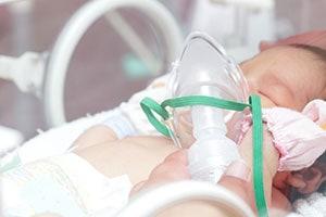 Newborn with Breathing Mask