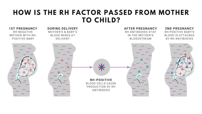 Pregnancy and Rh Incompatibility