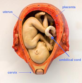 Abnormal Cord Insertion