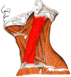 An anatomical diagram showing the location of the sternocleidomastoid muscle on the side of the neck.