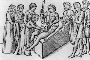 Cesarean History